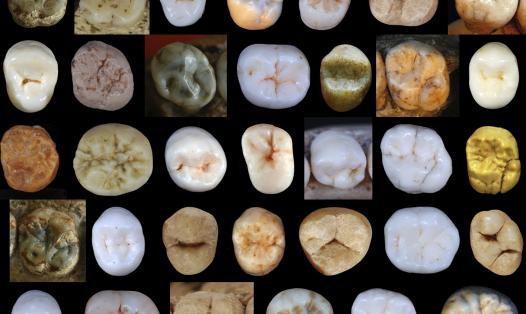 Mosaic showing posterior teeth (premolars and molars) of different hominin species, illustrating variation across species and different levels of dental reduction.